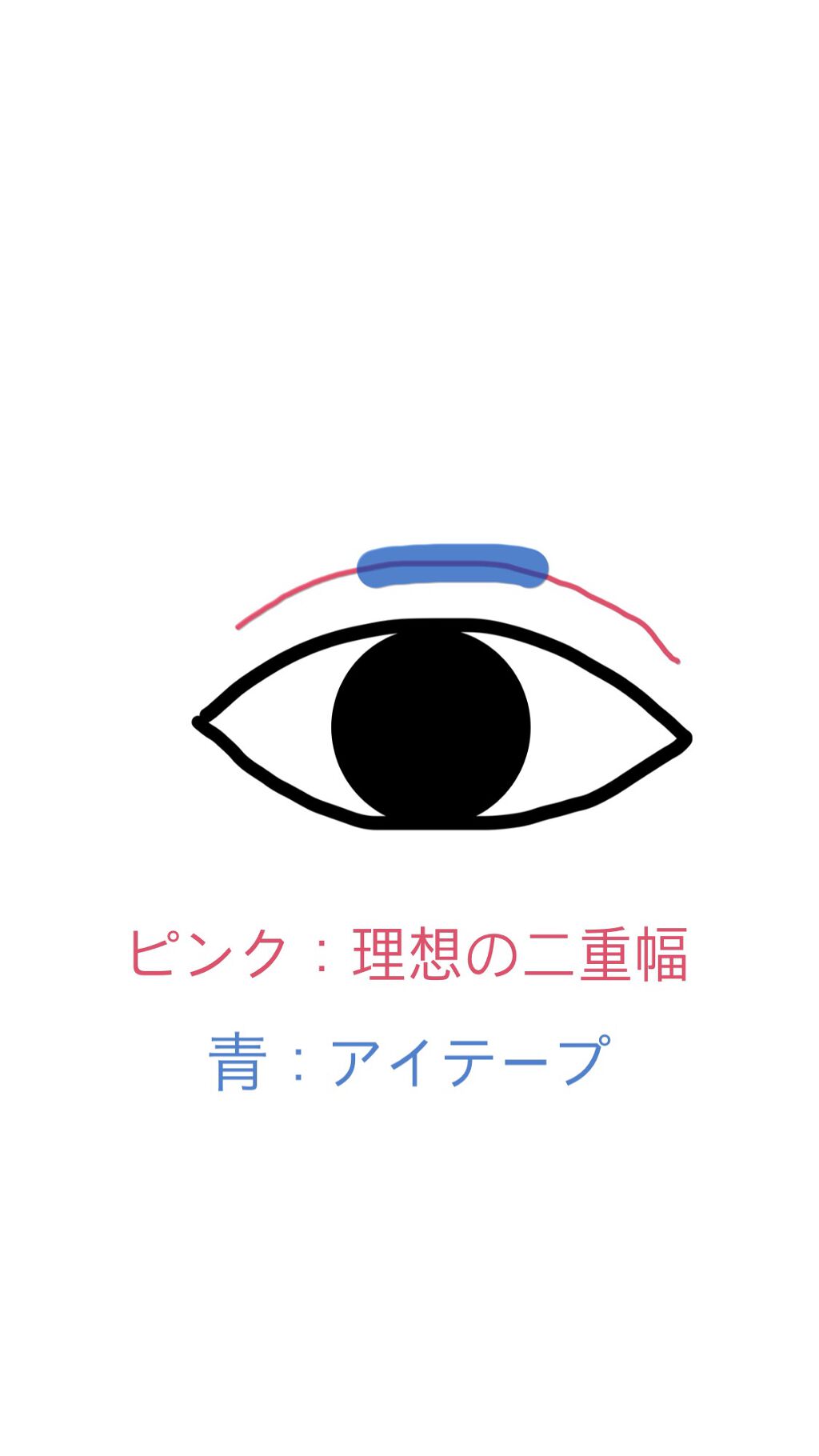アイテープ(絆創膏タイプ、レギュラー、70枚)/DAISO/二重まぶた用アイテムを使ったクチコミ(3枚目)
