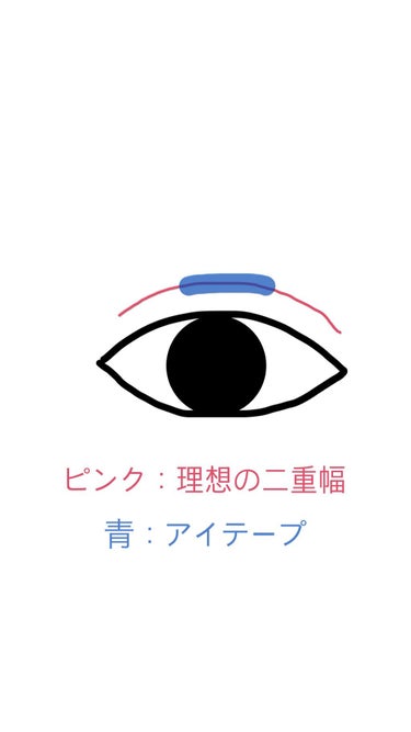 アイテープ（絆創膏タイプ、レギュラー、７０枚）/DAISO/二重まぶた用アイテムを使ったクチコミ（3枚目）