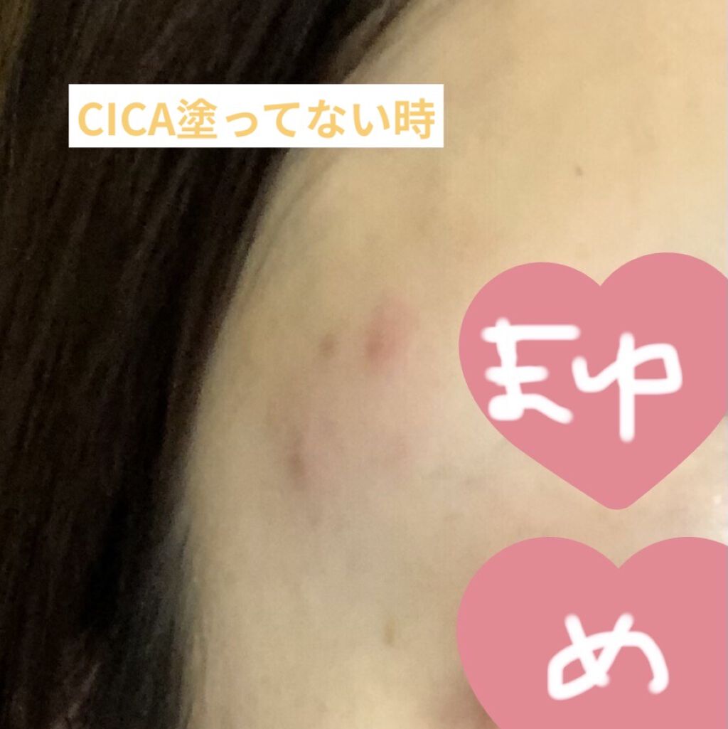 CICA クリーム/VT/フェイスクリームを使ったクチコミ（3枚目）
