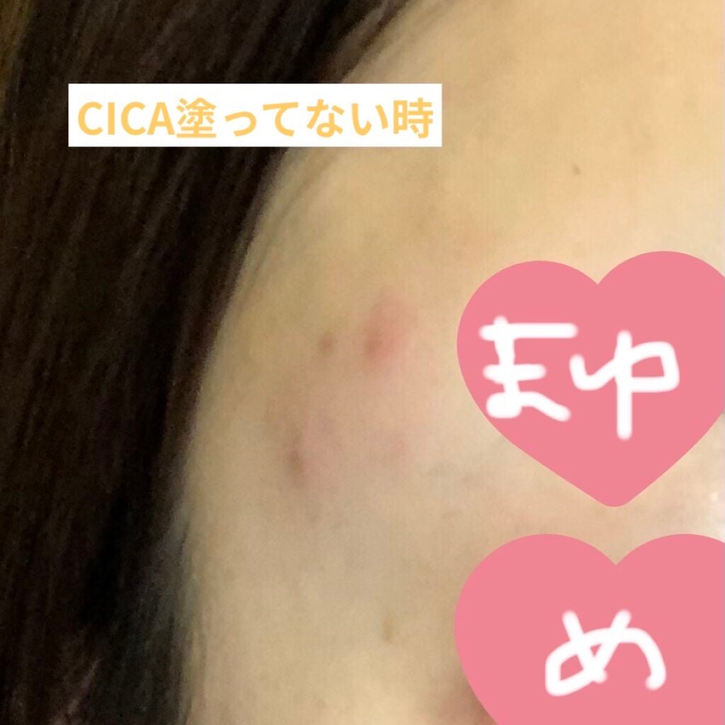 CICA クリーム/VT/フェイスクリームを使ったクチコミ(3枚目)