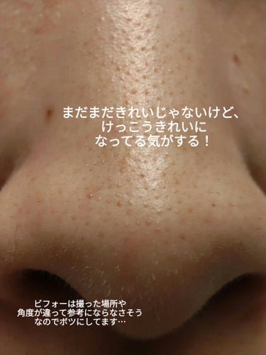 ディープクリア酵素洗顔	/メラノCC/洗顔フォームを使ったクチコミ（7枚目）