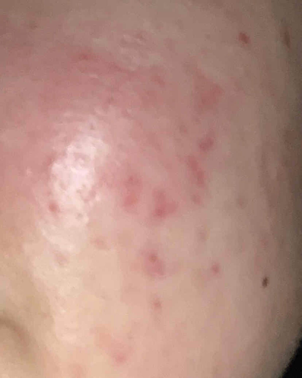 エスカメル(医薬品)/佐藤製薬/その他を使ったクチコミ(2枚目)