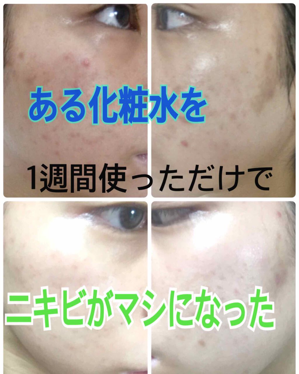 潤い化粧水/ももぷり/化粧水を使ったクチコミ（1枚目）