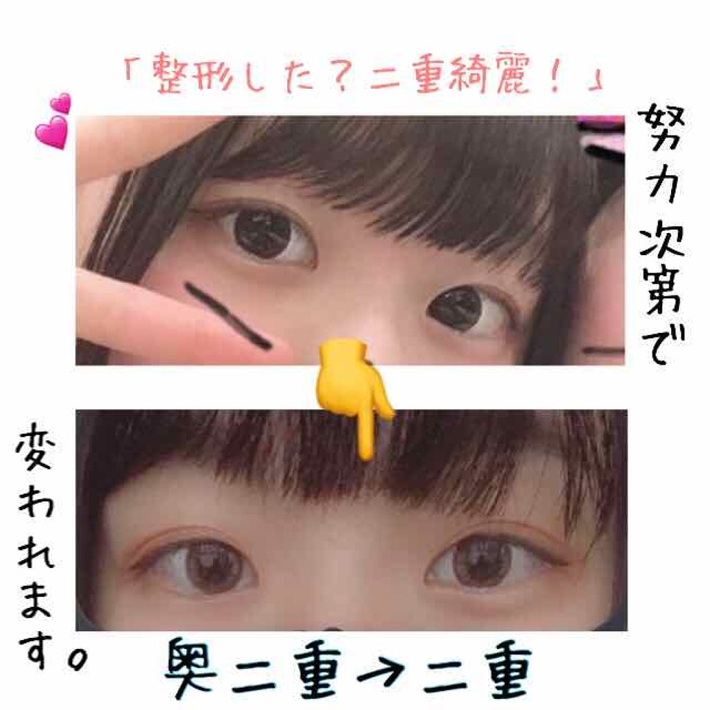 のびーるアイテープ（絆創膏タイプ、レギュラー）/DAISO/二重まぶた用アイテムを使ったクチコミ（1枚目）