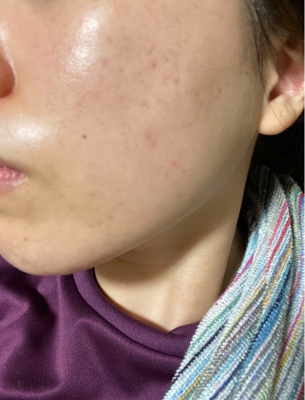 ホワイトニング ミスト セラム/アルージェ/ミスト状化粧水を使ったクチコミ(3枚目)