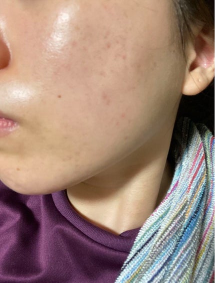 コンセントレート インジュビネーション マスク/ジュレリッチ/シートマスク・パックを使ったクチコミ(3枚目)