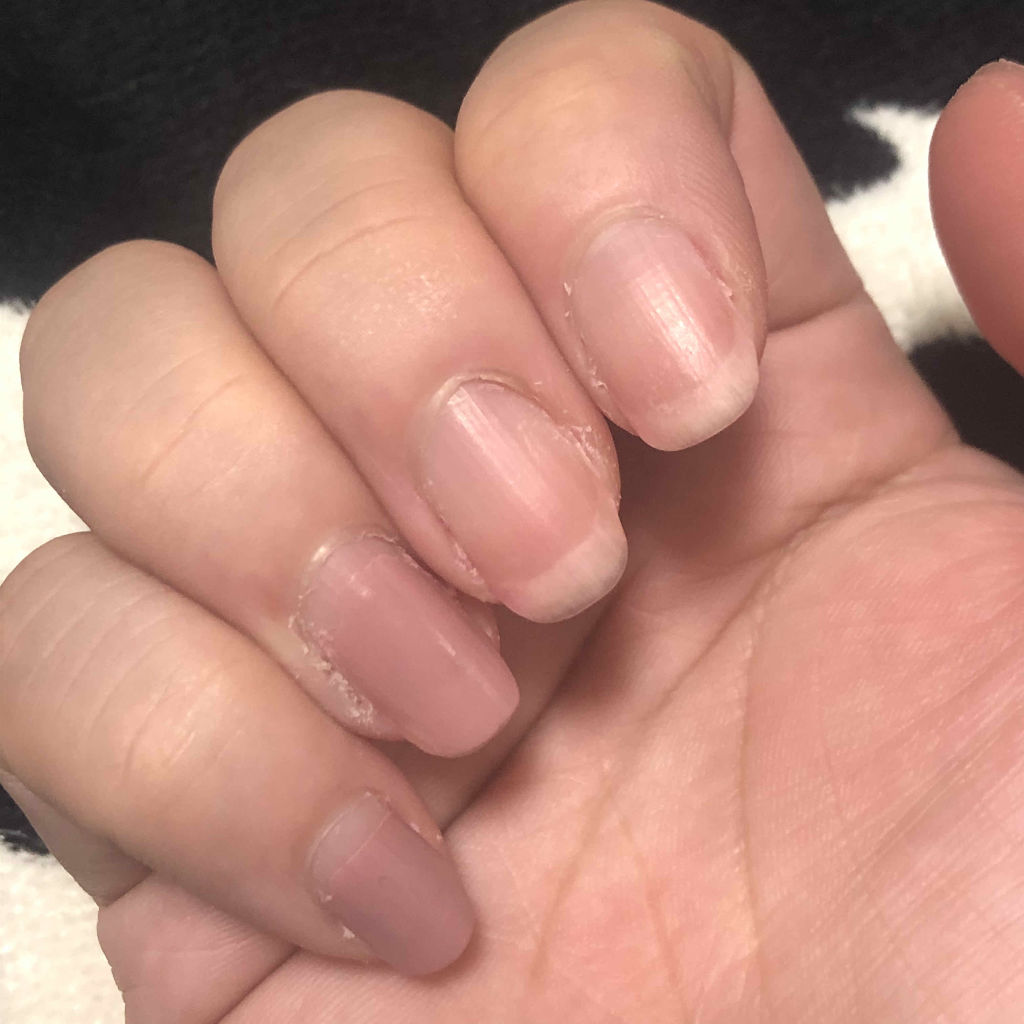 AT トップ＆ベースコート/Art Collection/ネイルトップコートを使ったクチコミ（2枚目）