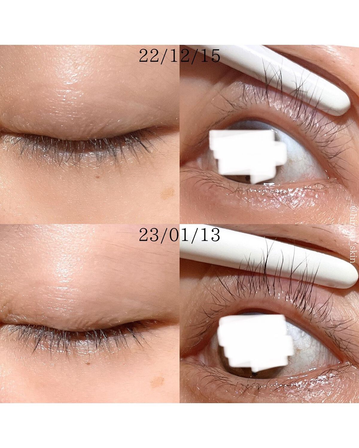 ラッシュリッチアイラッシュセラム/ロート製薬/まつげ美容液を使ったクチコミ(6枚目)