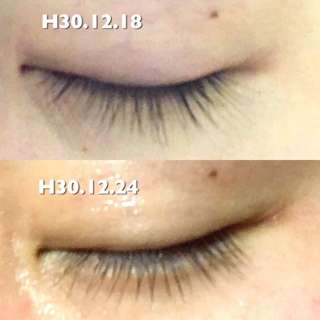 スカルプD ボーテ ピュアフリーアイラッシュセラム/アンファー(スカルプD)/まつげ美容液を使ったクチコミ(2枚目)