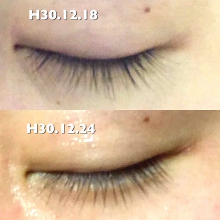 スカルプD ボーテ ピュアフリーアイラッシュセラム/アンファー(スカルプD)/まつげ美容液を使ったクチコミ(2枚目)