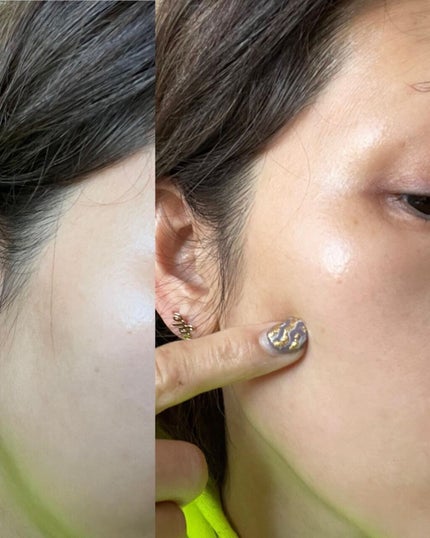 ちゃんまぃ on LIPS 「🟩OKCICAクリアパッチMEN'S用品らしいのですが、女子も..」(5枚目)