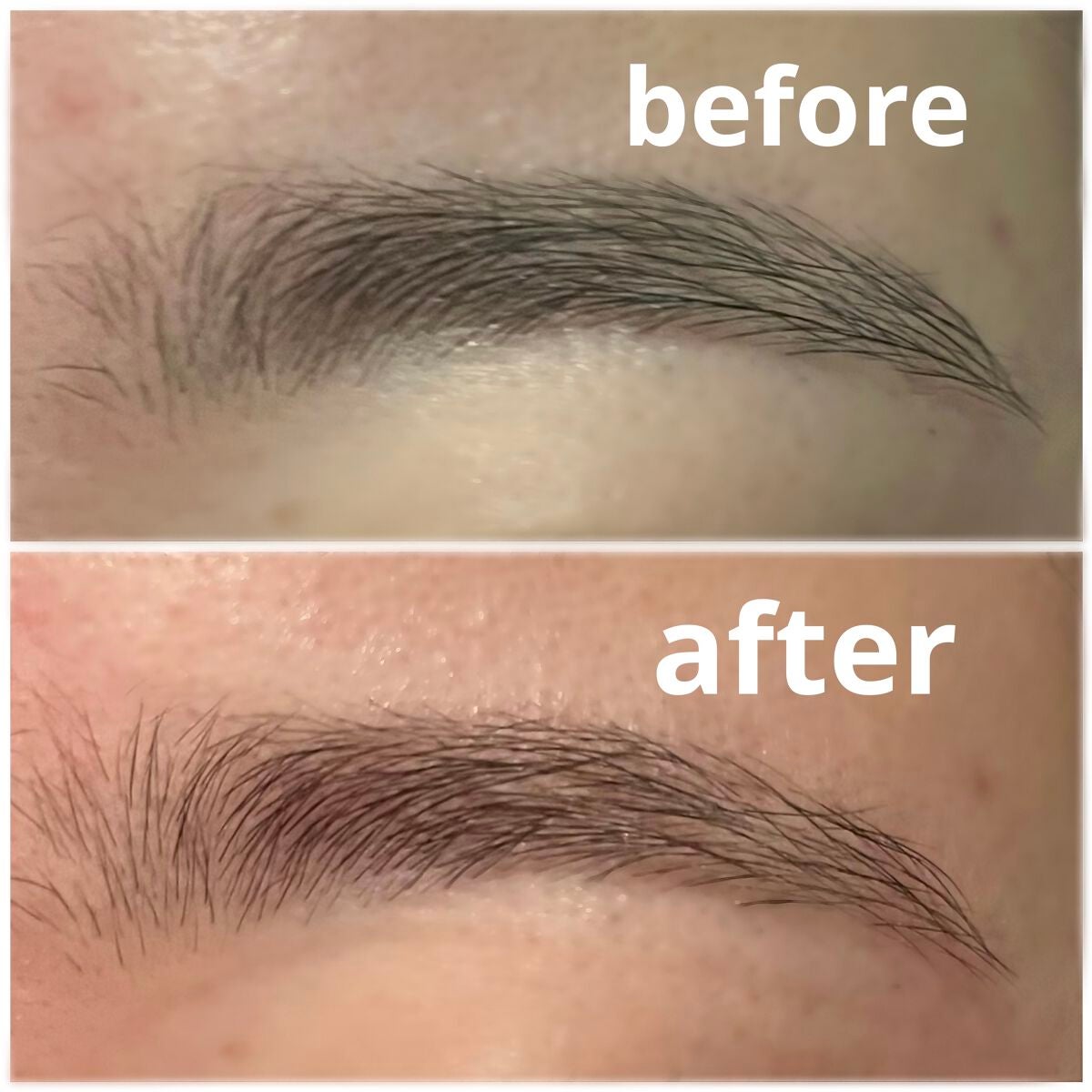 脱色クリーム スピーディー/エピラット/ムダ毛ケアを使ったクチコミ(5枚目)