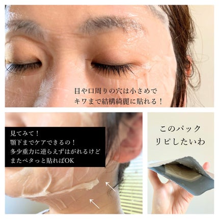 レッドブレミッシュ クリアスージングクリーム/Dr.G/フェイスクリームを使ったクチコミ(10枚目)