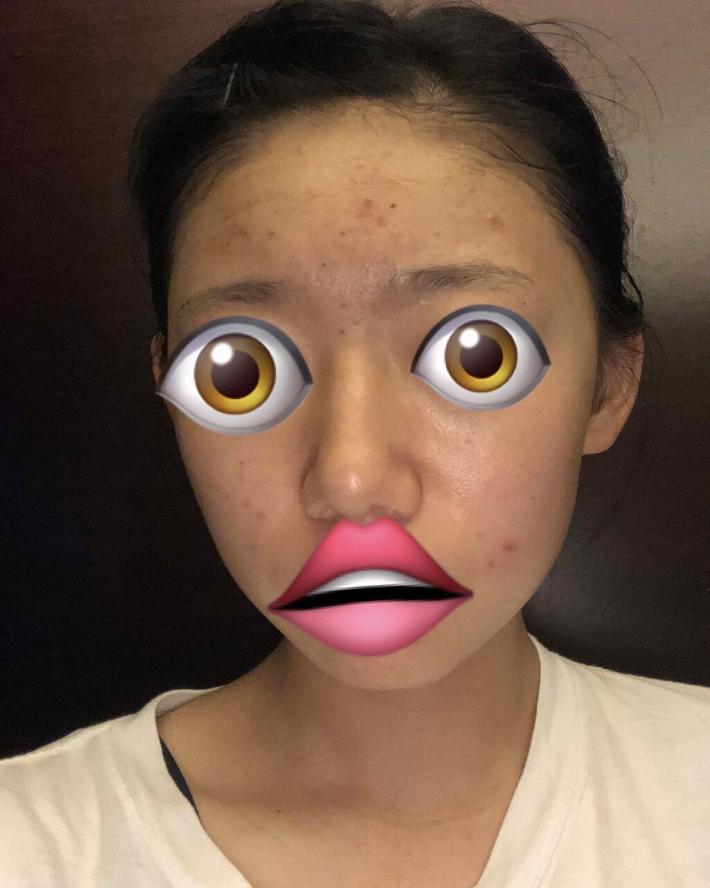 シノノメ_アイリ on LIPS 「10日目変わってるのかはわからないけどニキビ2個新しくできた😔..」(2枚目)