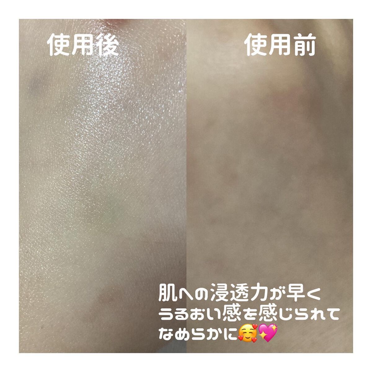 エファクラ ピールケア セラム/ラ ロッシュ ポゼ/美容液を使ったクチコミ（2枚目）