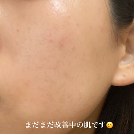 (旧)アンリミテッド ラスティング フルイド/shu uemura/リキッドファンデーションを使ったクチコミ(4枚目)