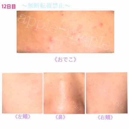 ロゼット 洗顔パスタ 荒性肌/ロゼット/洗顔フォームを使ったクチコミ(3枚目)