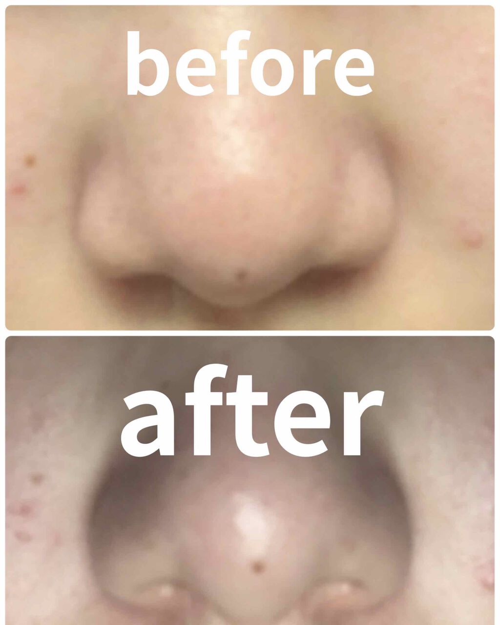 ホホバオイル/無印良品/ボディオイルを使ったクチコミ（3枚目）