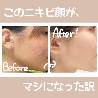 モイスチャージェル1|エンビロンを使った口コミ 「こんにちは ...