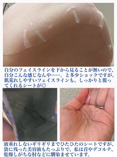 薬用ルルルン 保湿スキンコンディション/ルルルン/シートマスク・パックを使ったクチコミ（4枚目）