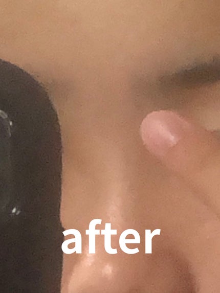 凪 on LIPS 「個人的大優勝!!!おすすめパック🧖🏻♀️🛁皆さん〜!!はじめ..」(5枚目)