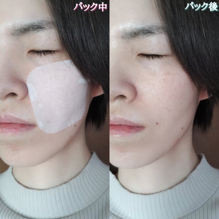 マデカソサイド ブレミッシュパッド/MEDIHEAL/トナーパッドを使ったクチコミ(8枚目)