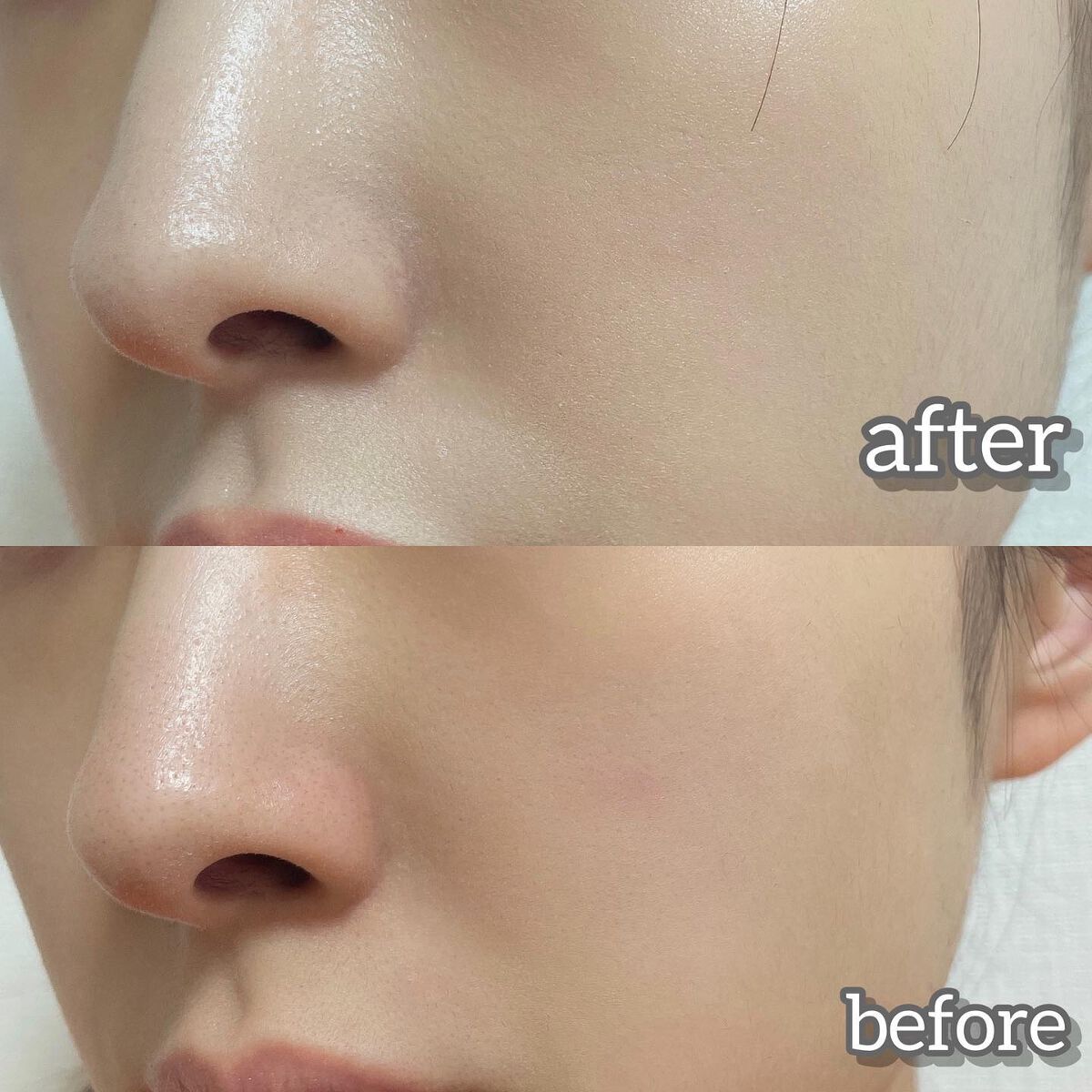 スリムフィットエバーグロウクッション/Dear.A/クッションファンデーションを使ったクチコミ(5枚目)