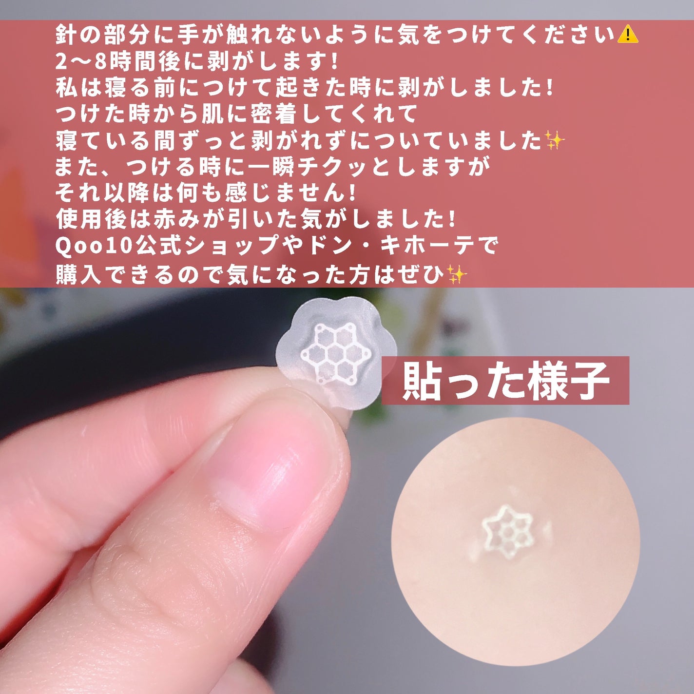 ACマグネシウムパッチ ミニ/スノーツープラス/にきびパッチを使ったクチコミ(3枚目)