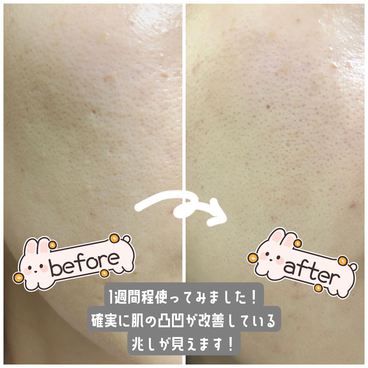 ユース ラディアンス ビタチノール セラム/primera/美容液を使ったクチコミ（3枚目）