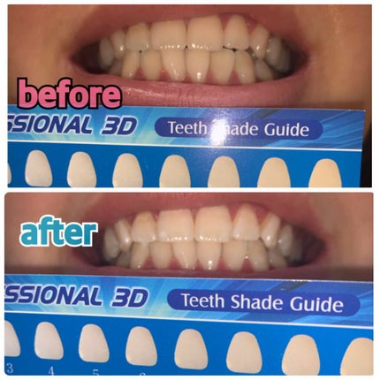 を使ったクチコミ(2枚目)