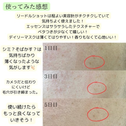 リードルショット100/VT/美容液を使ったクチコミ(4枚目)