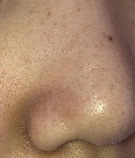 ジョンソンベビーオイル微香性/ジョンソンベビー/ボディオイルを使ったクチコミ(4枚目)