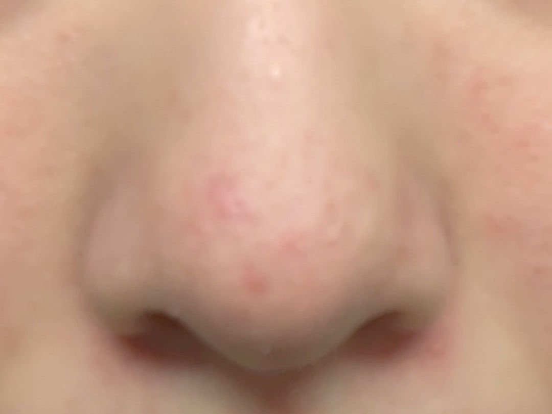 鼻 バブルパック/CNP Laboratory/シートマスク・パックを使ったクチコミ（2枚目）