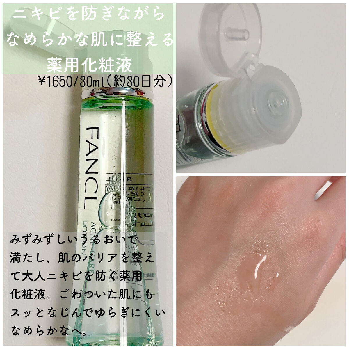 アクネケア 化粧液　＜医薬部外品＞/ファンケル/化粧水を使ったクチコミ（2枚目）