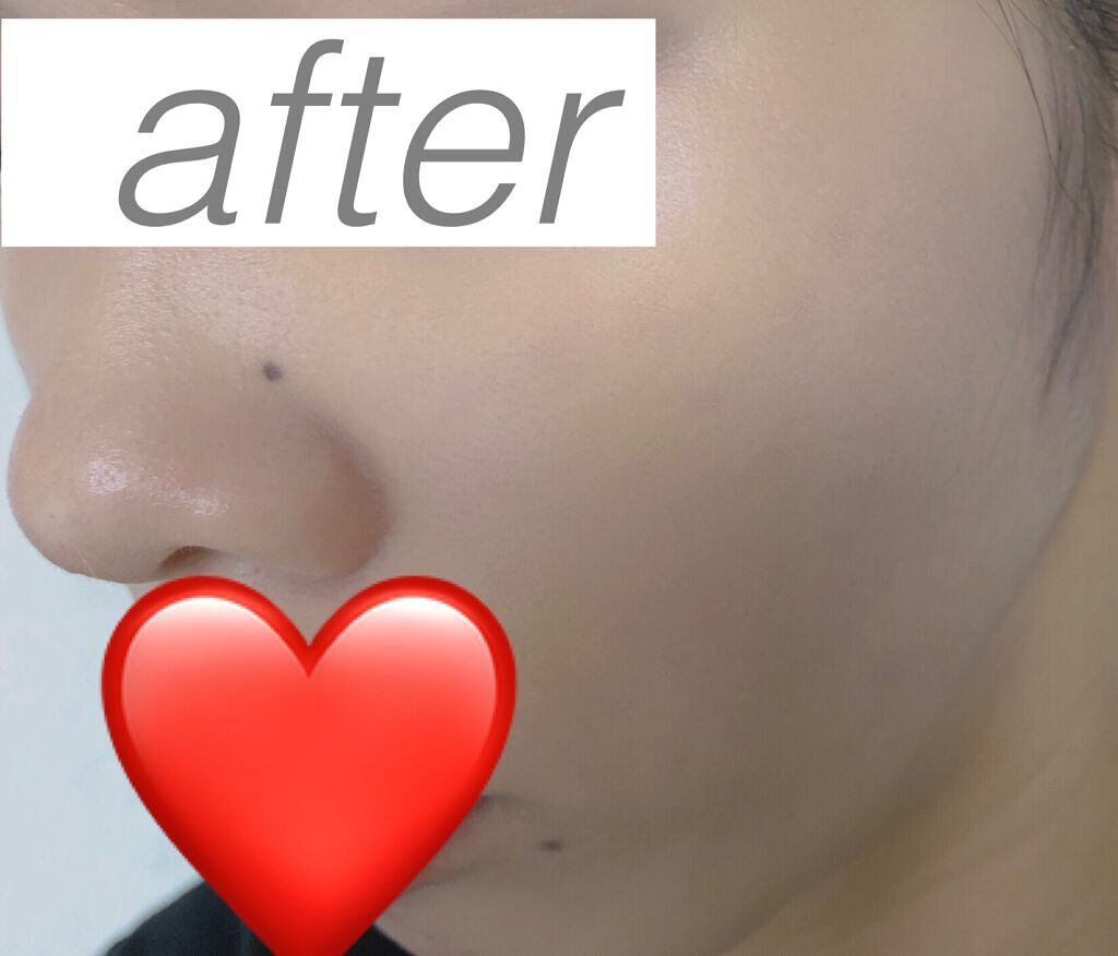 （旧）アンリミテッド ラスティング フルイド/shu uemura/リキッドファンデーションを使ったクチコミ（3枚目）