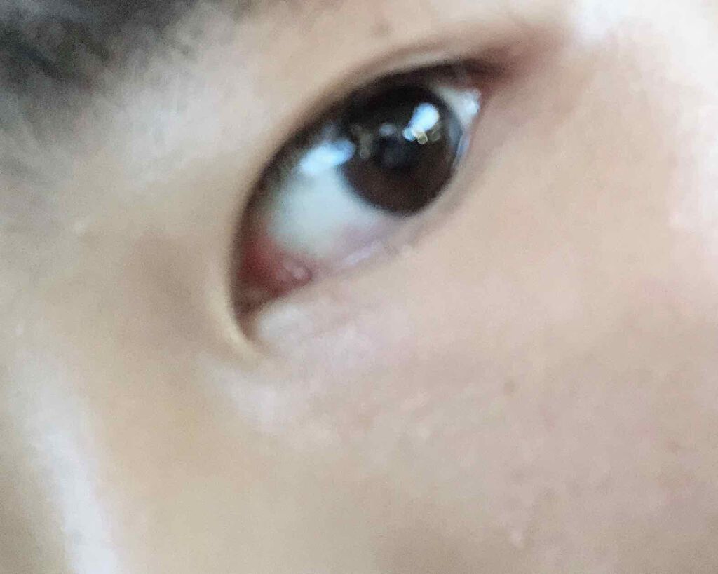 アイトーク/アイトーク/二重まぶた用アイテムを使ったクチコミ(1枚目)