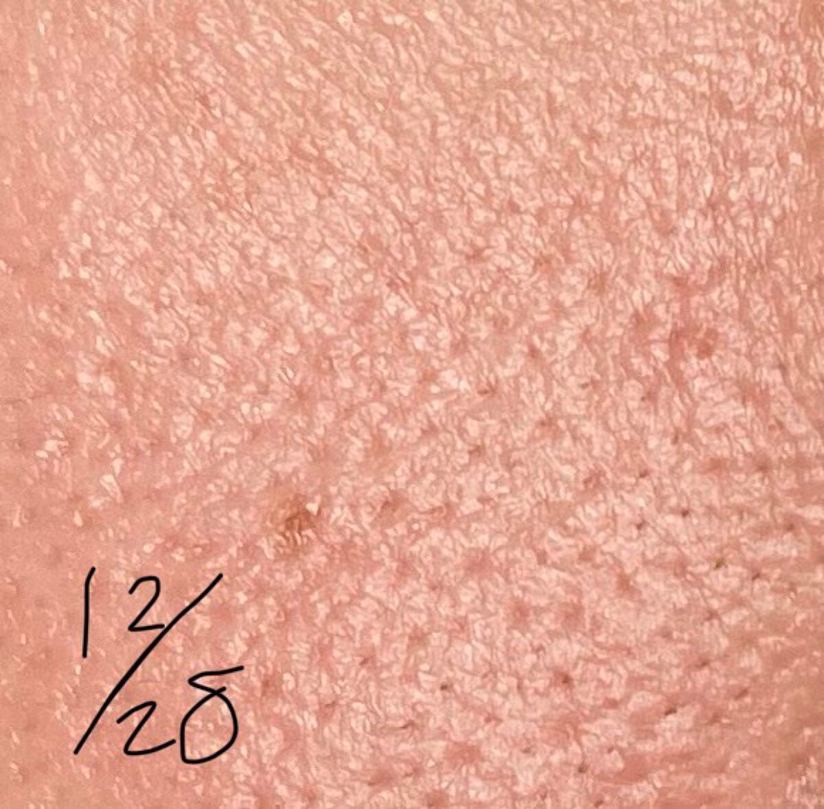 ガラクナイアシン2.0エッセンス/manyo/美容液を使ったクチコミ(8枚目)