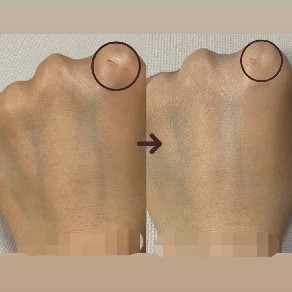 プロポリスアンプルインクッション/CNP Laboratory/クッションファンデーションを使ったクチコミ（2枚目）