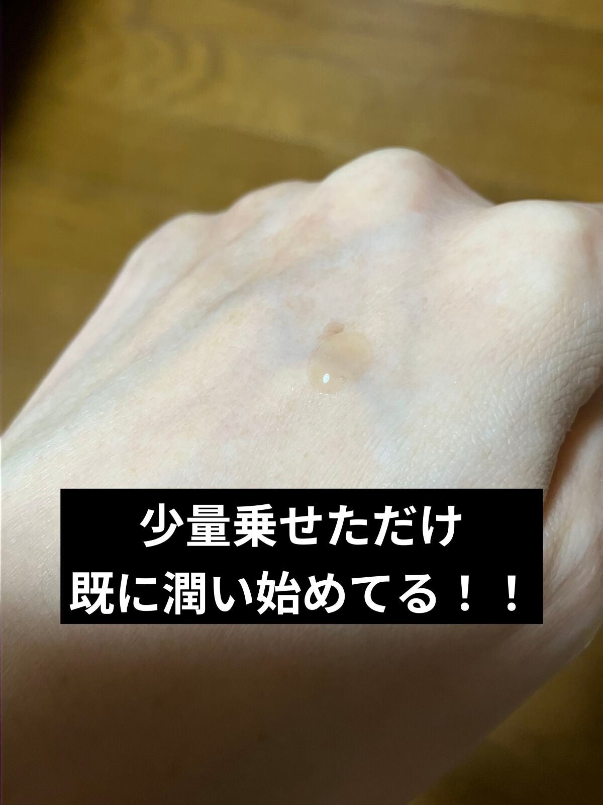 ビフィダバイオームコンプレックスセラム/manyo/美容液を使ったクチコミ(3枚目)