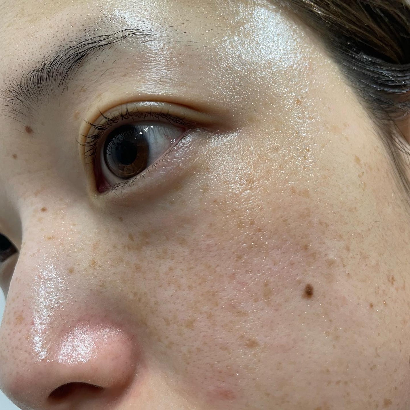 AZアゼライン酸10セラム/コスデバハ/美容液を使ったクチコミ(4枚目)