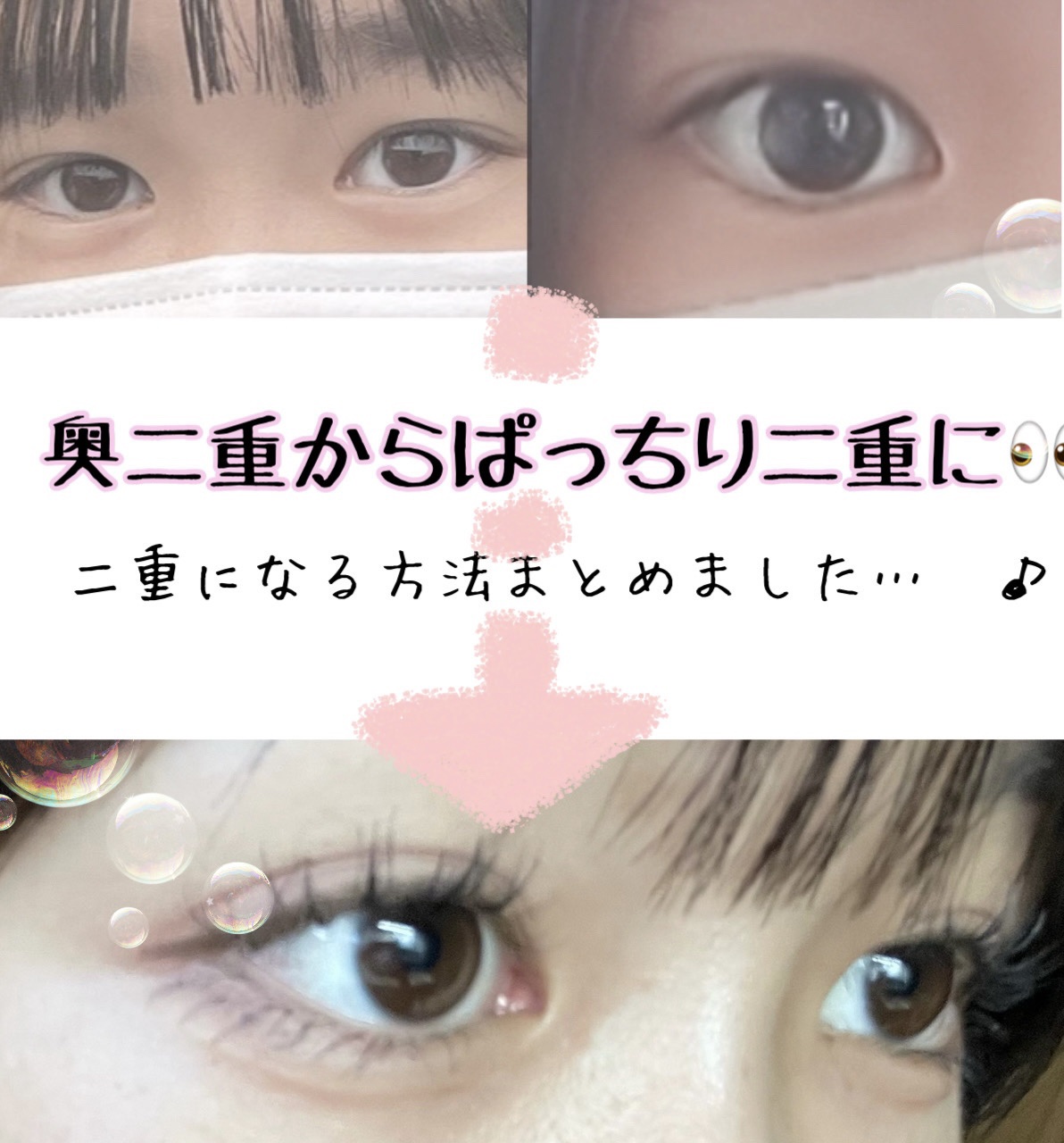 アイビューティー フィクサー WP/アストレア ヴィルゴ/二重まぶた用アイテムを使ったクチコミ（1枚目）