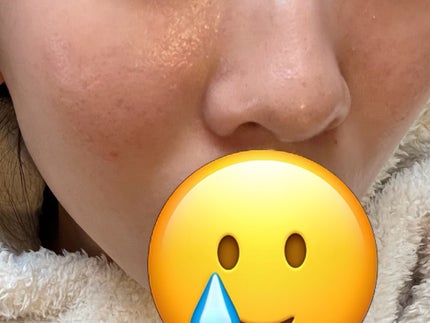 レシピオ モイストローションR/レシピオ/化粧水を使ったクチコミ(4枚目)