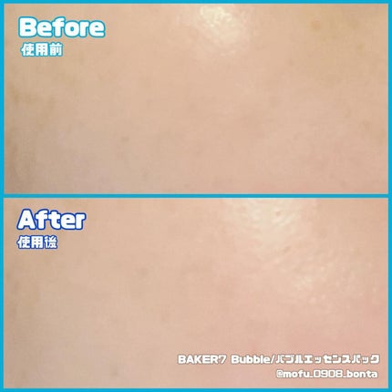 マジックバブルエッセンスパックMINI/BAKER7/シートマスク・パックを使ったクチコミ(3枚目)