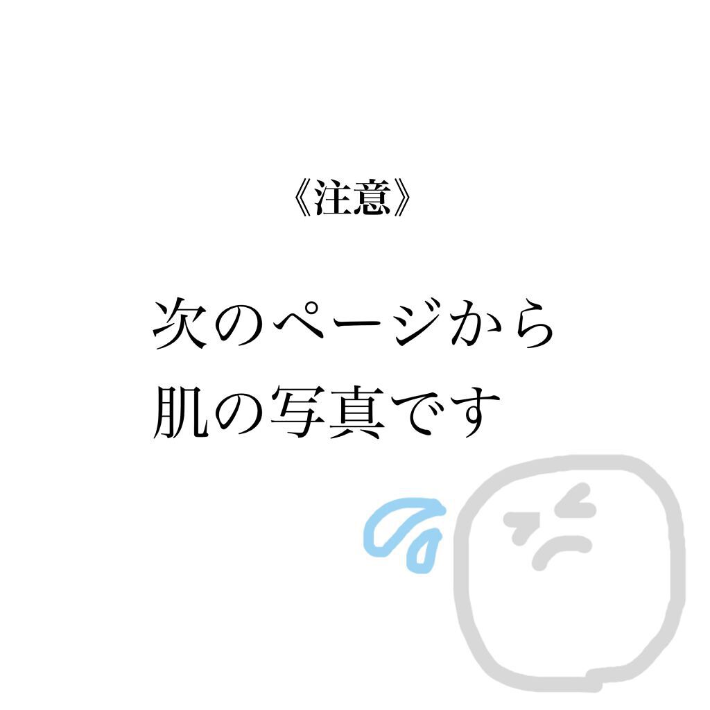 パワーマスク SP/ラッシュ/スクラブ・ゴマージュを使ったクチコミ(4枚目)