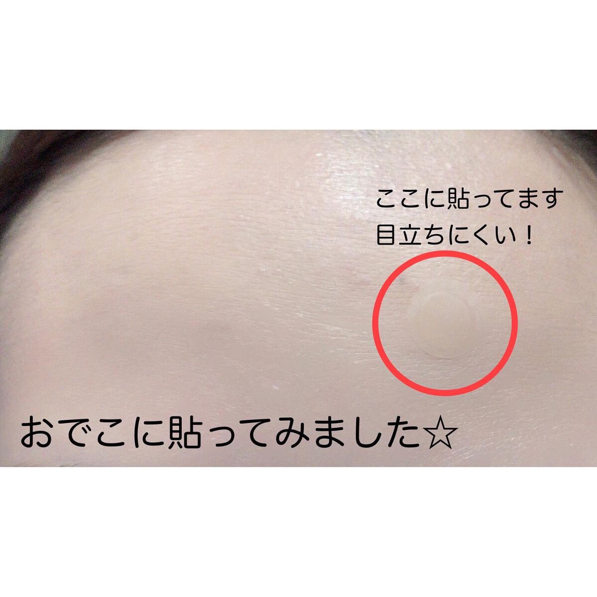 ゼロスポットパッチ/Today’s Cosme/にきびパッチを使ったクチコミ（3枚目）