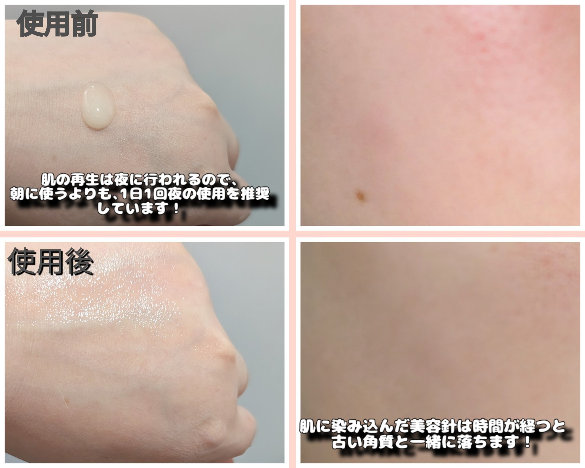 を使ったクチコミ（3枚目）