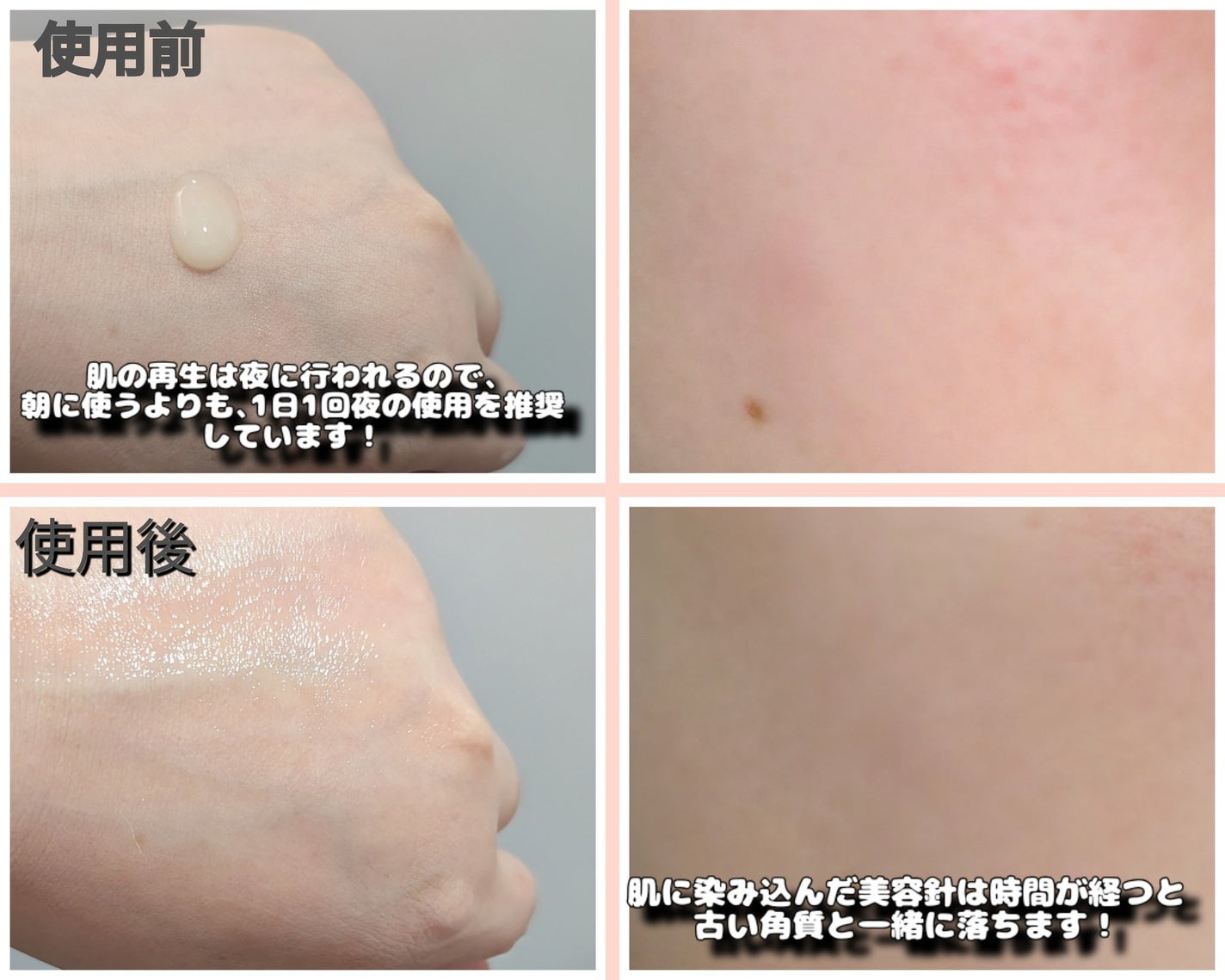 ç²è¶ðµ on LIPS ãããªããšåºæ¿ã¯ãã£ããã©ïœ€èããããçã¿ã ãèãèããããšã..ãïŒ3æç®ïŒ