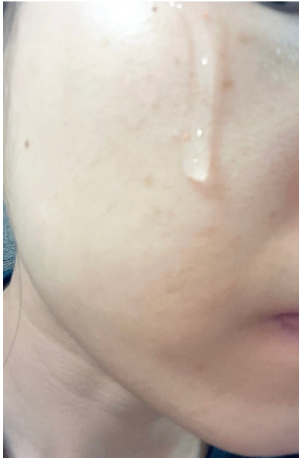 復活草ビフィダセラムファーミングドロップ/Abib /美容液を使ったクチコミ(6枚目)