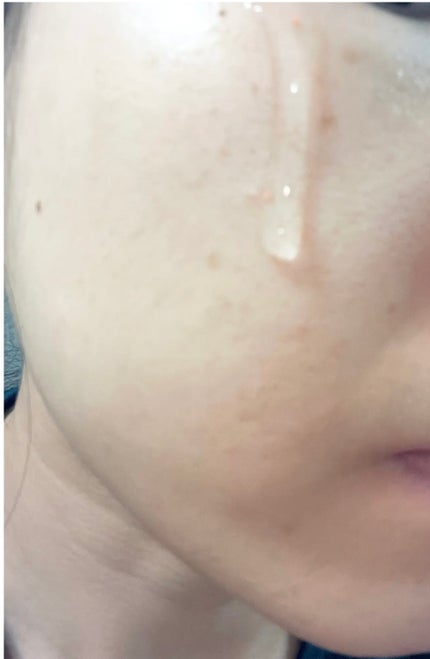 復活草ビフィダセラムファーミングドロップ/Abib /美容液を使ったクチコミ(6枚目)