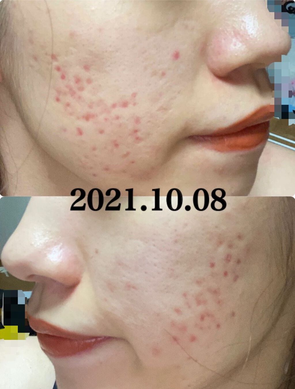 ロゼット 洗顔パスタ 白泥リフト/ロゼット/洗顔フォームを使ったクチコミ(6枚目)